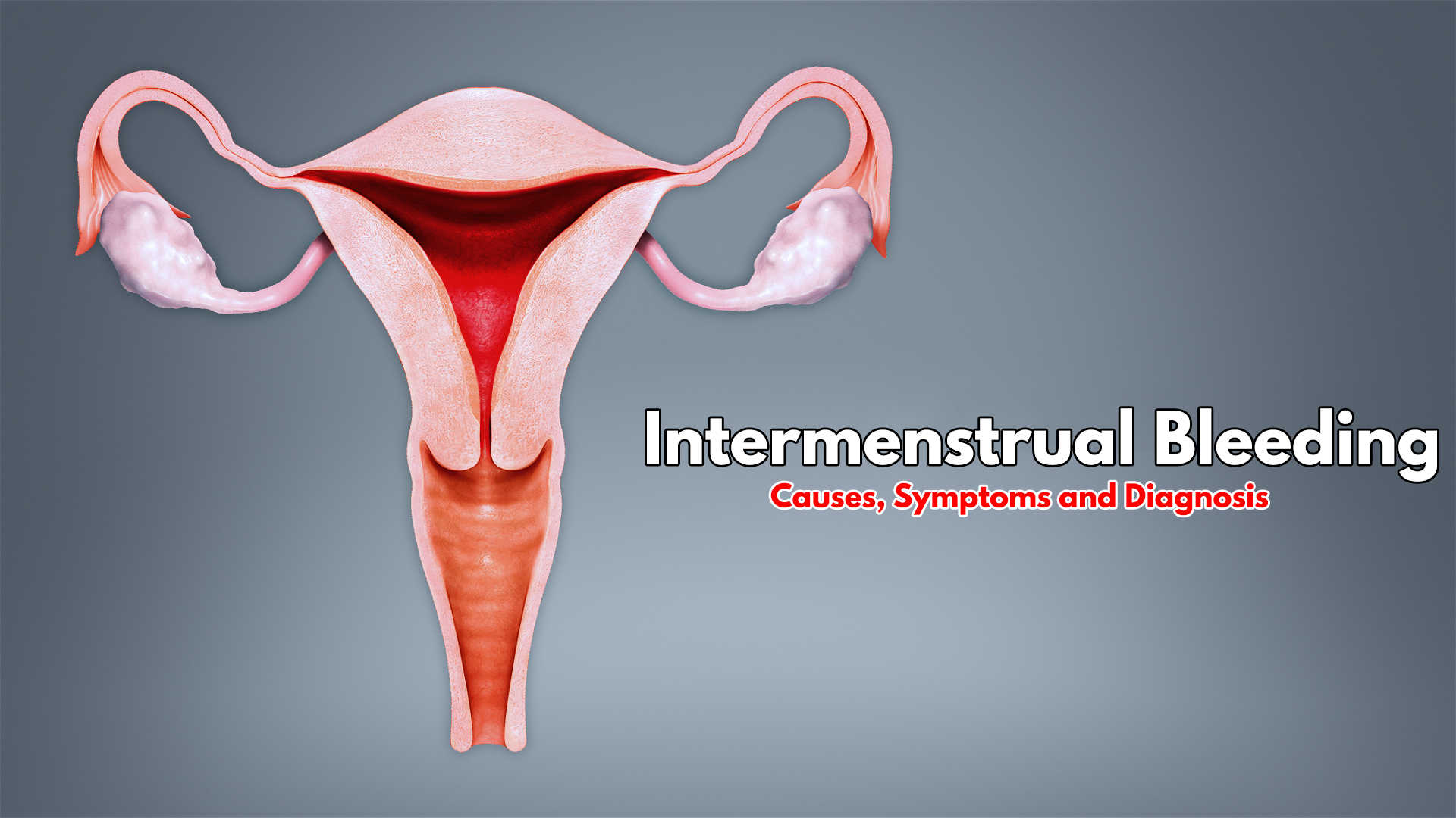 Intermenstrual Bleeding