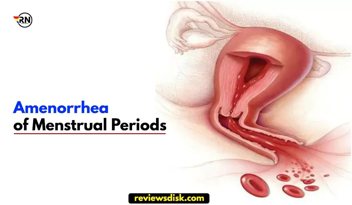 Absence of Menstrual Periods All You Need to Know