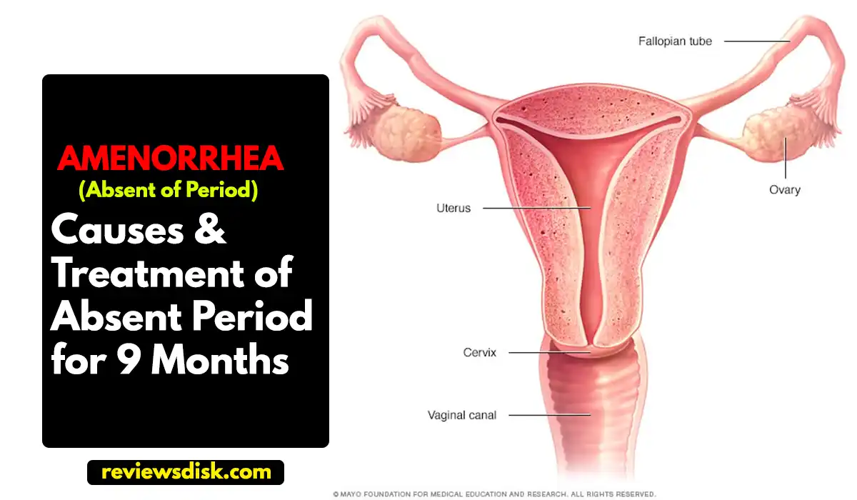 Causes and Best Treatment of Absent Periods for 9 Months